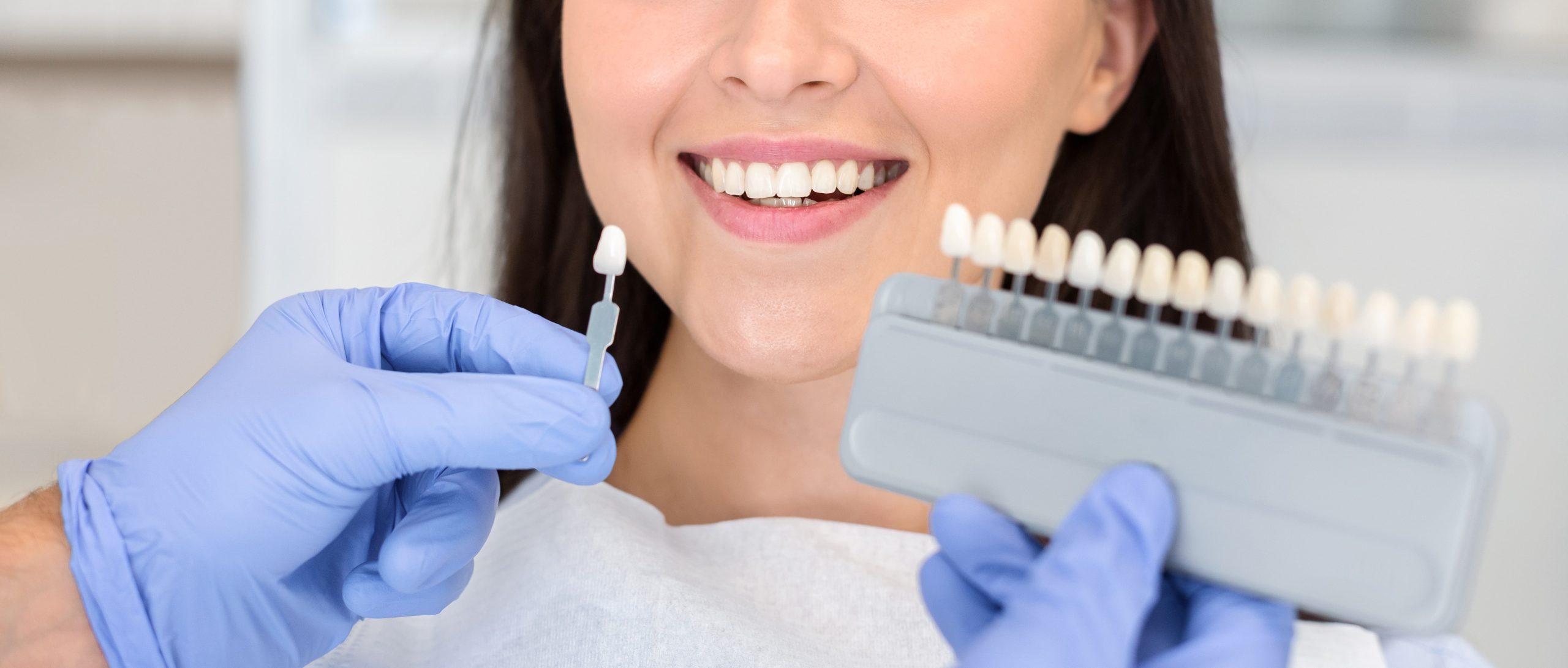 Top Big Header - Veneer Payment Plans