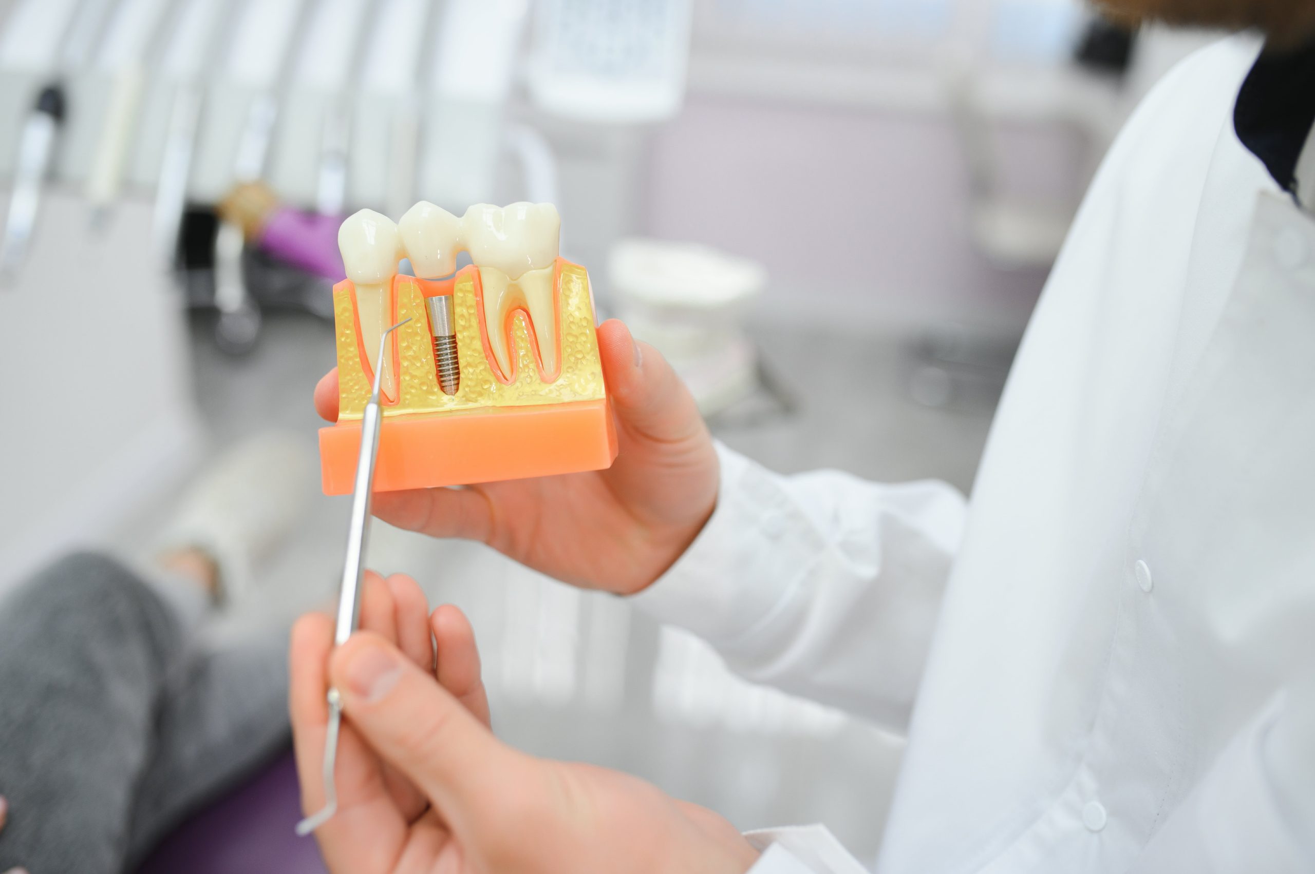 Top Big Header - Dental Implants