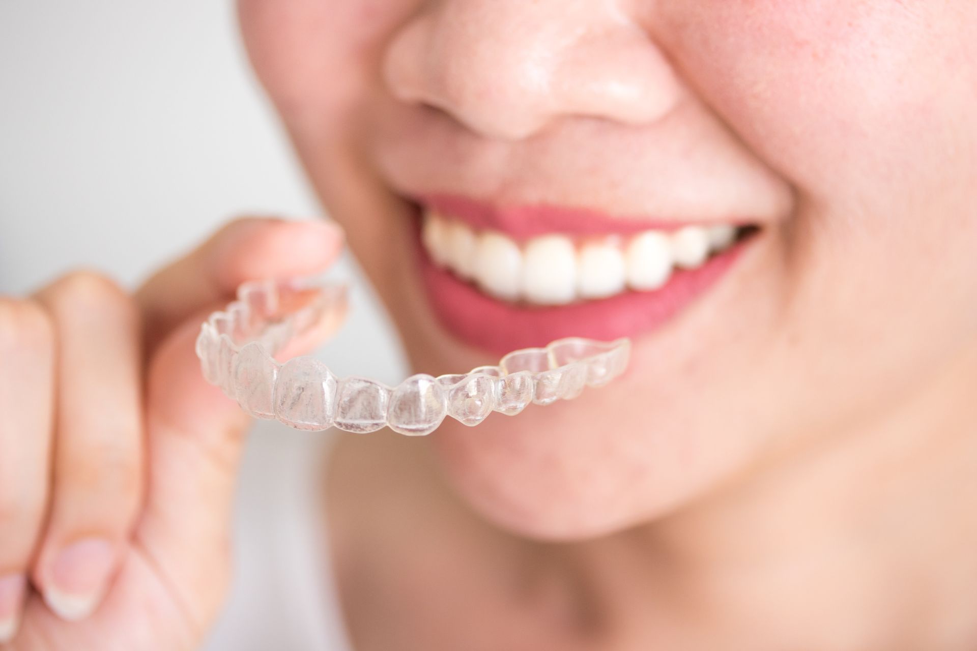 Top Big Header - What's the Best Age for Invisalign?