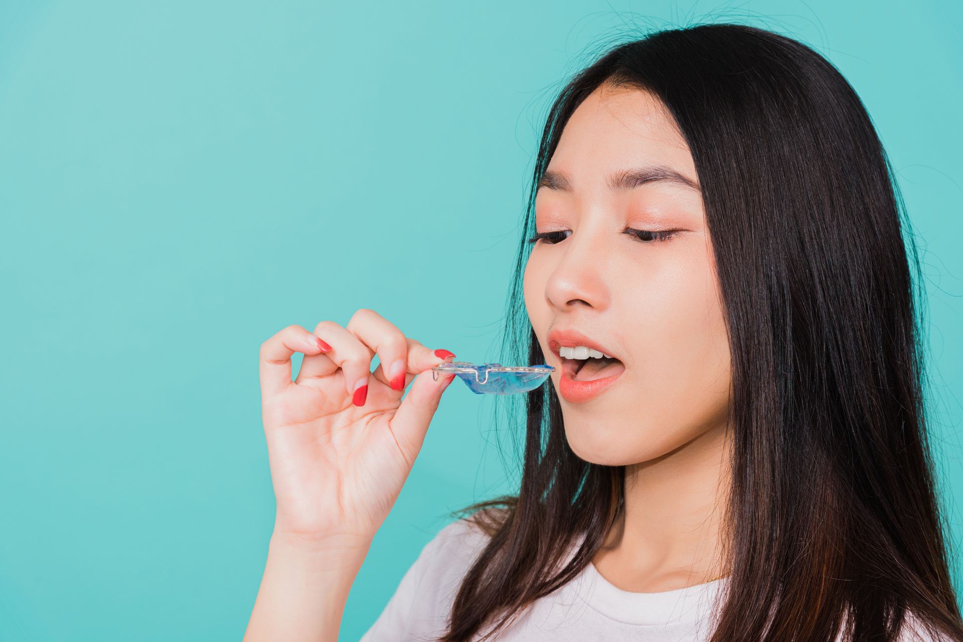 Top Big Header - Do You Have to Wear a Retainer Forever After Invisalign?